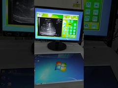 Фиксированный источник волны экстракорпоральная ударная волна литотрипсическая машина УЗИ система определения местоположения