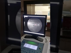 Высокоточный экстракорпоральный ударный волновой аппарат, ударная литорипсическая рентгеновская система