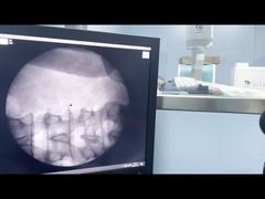 Высокочастотный экстракорпоральный ударный волновой аппарат с фокусирующим аппликатором 1-16 Гц 100 Вт